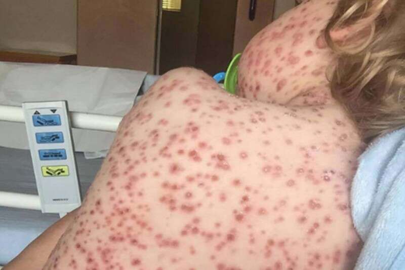 כוסה בכל הגוף, ג'ספר בבית החולים // צילום: מתוך טוויטר