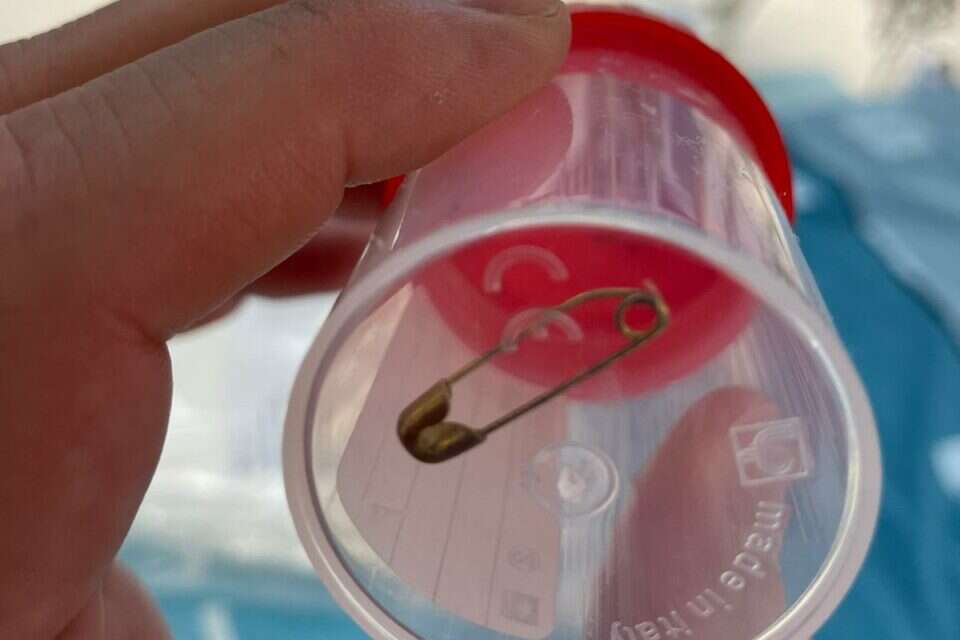 סיכת הביטחון שהוצאה מגוף התינוקת בהדסה , דוברות הדסה