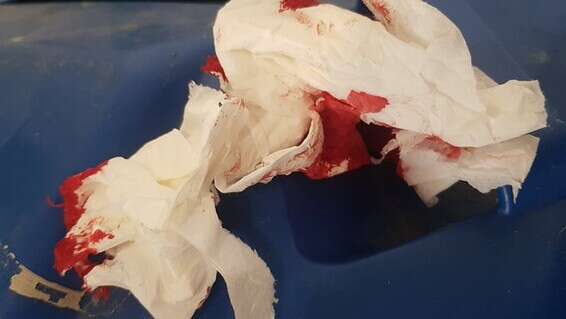 תוצאות התקיפה // צילום: אפרים דוד