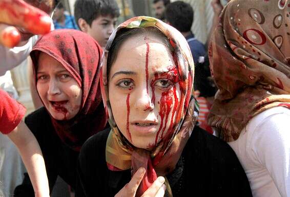 פצועה באזור חאלב // צילום: אי.פי