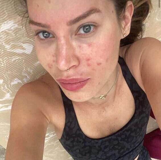 לרגע לא חשבנו שאת לא בסדר, כפי שלא טעינו לחשוב שאת מושלמת // צילום מסך, מתוך האינסטגרם