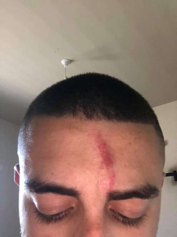 הוצמד לכביש ע"י 3 שוטרים // צילום: מתוך עמוד הפייסבוק של רועי מויאל