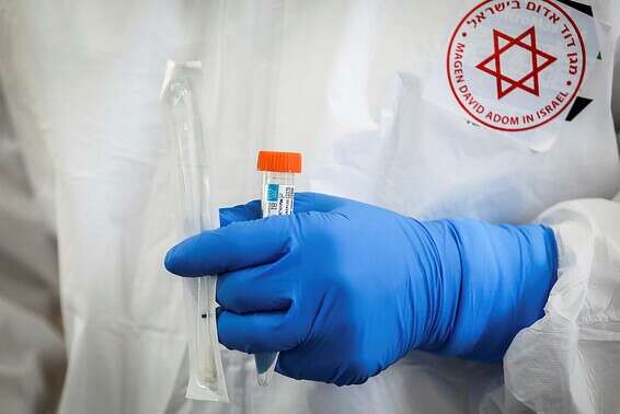 המפתח בסוג הדם? בדיקה לאיתור קורונה // צילום: אורן בן חקון