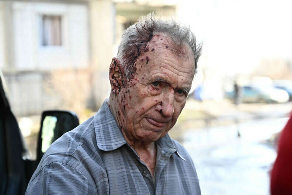 אזרח אוקראיני שנפגע בהפגזות , אי.אף.פי