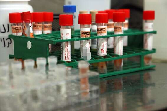 בדיקות לגילוי נגיף הקורונה // צילום גדעון מרקוביץ'