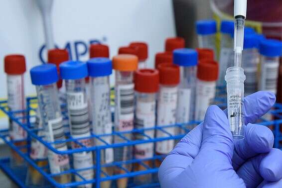 יותר בדיקות - יותר מאומתים ולהיפך // צילום ארכיון: אייל מרגולין, ג'יני