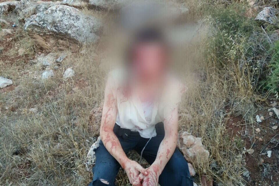 הצעיר שהותקף // צילום: מאחז עוז ציון , 