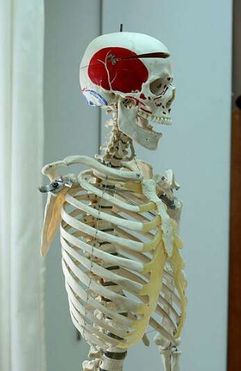 פוגע בהתפתחות תקינה של העצמות, שלד אנושי // צילום: משה שי