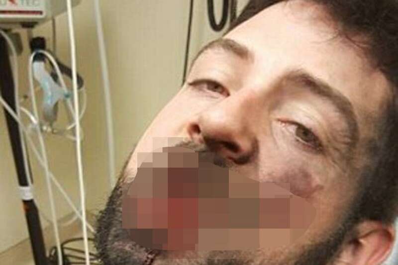 תמונה מטושטשת של הפה של אנדרו לאחר שאיבד 7 משיניו // צילום: מתוך פייסבוק