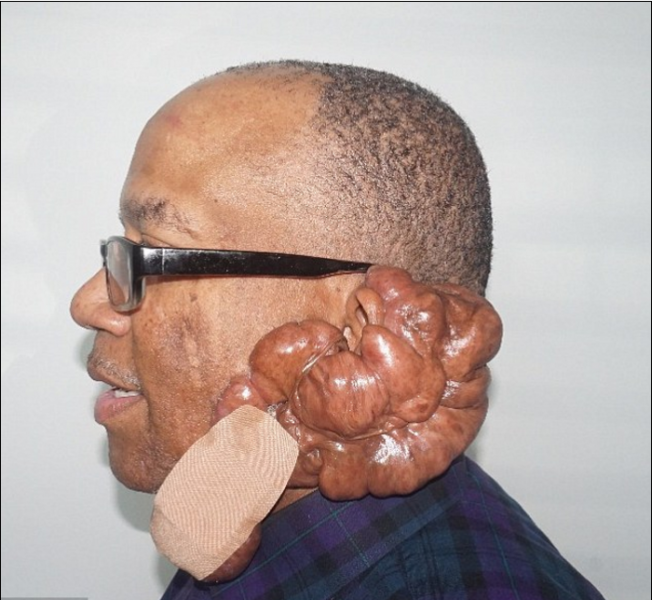 גם רפואי וגם אסתטי // צילום: GoFundMe