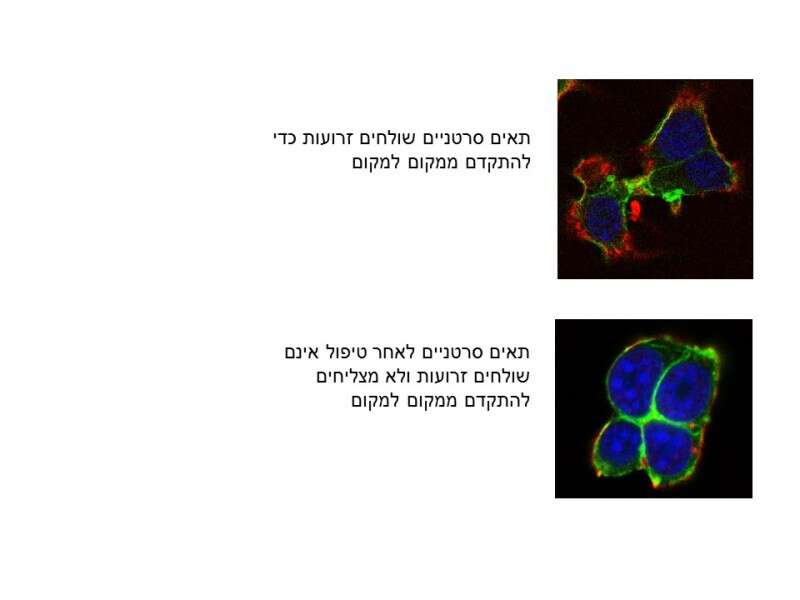 תאים סרטניים לפני ואחרי הטיפול // צילום: שיאון ניניו