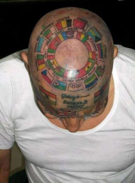 שיא גינס מוזר: הסיר את כל השיניים שלו