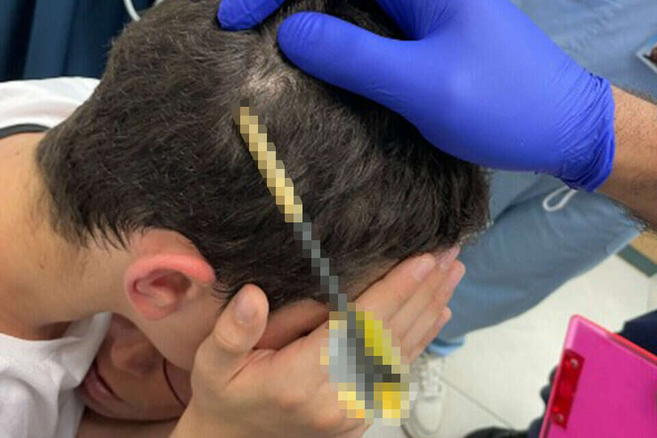 החץ בראשו של הילד , בטרם רפואה דחופה