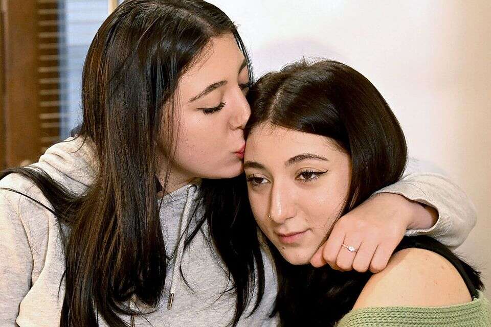 התאומות אנה ואלנה מגאוגרגיה, הופרדו בלידתן , איי.אף.פי