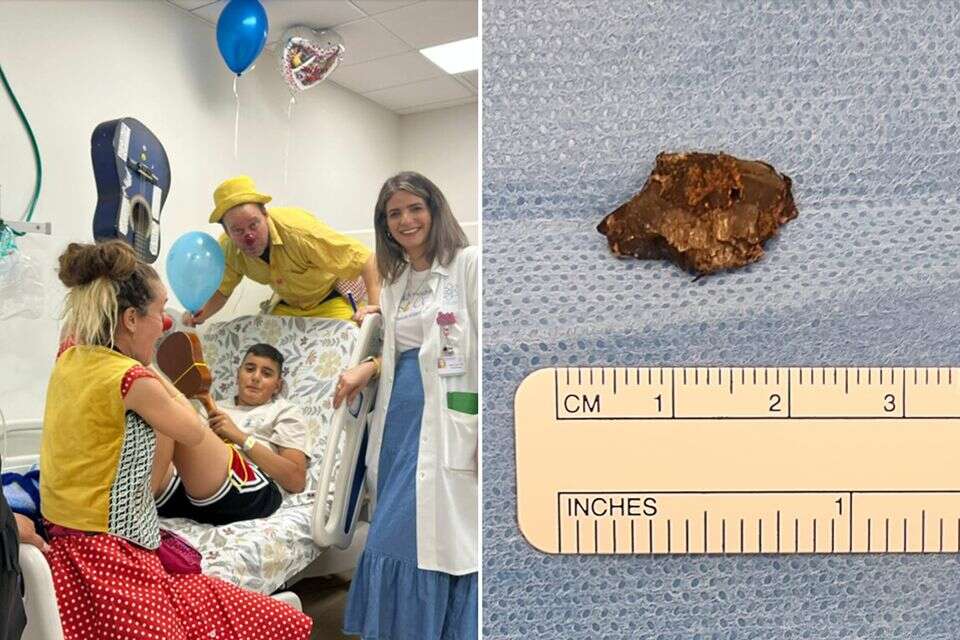 רסיס בגודל 18 מ"מ הוצא מגופו של אדם אלשער בן ה-12 שנפגע באסון מג'דל שמס , המרכז הרפואי לגליל