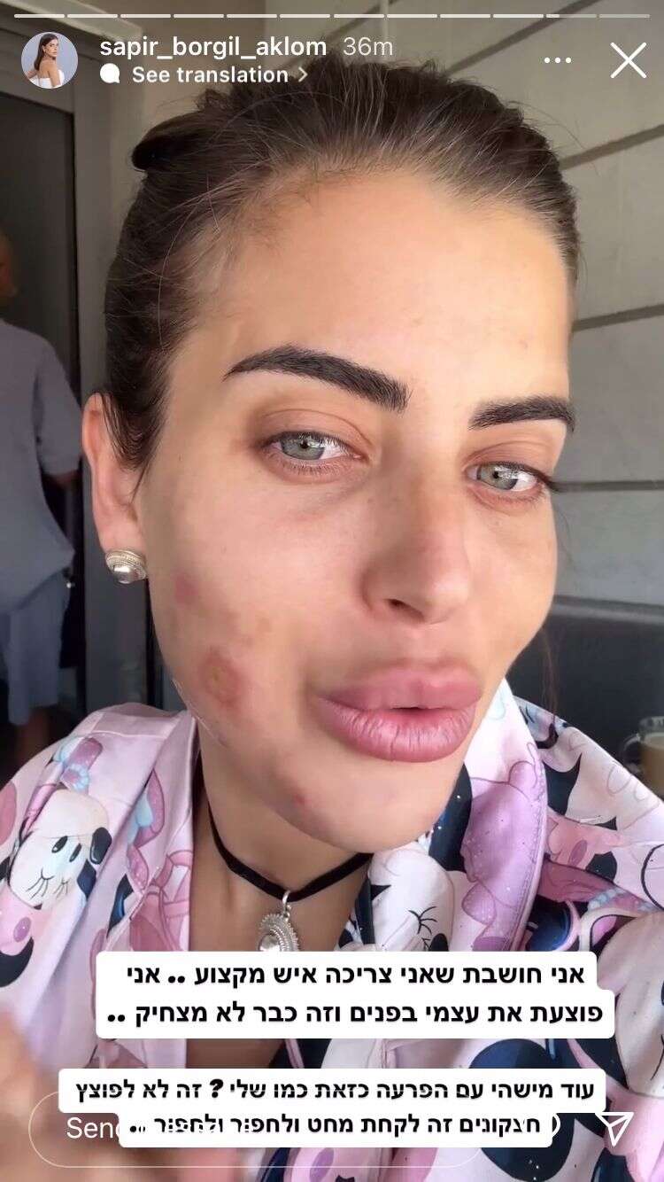 ספיר מציגה את הנזק שגרמה לעצמה , מתוך אינסטגרם