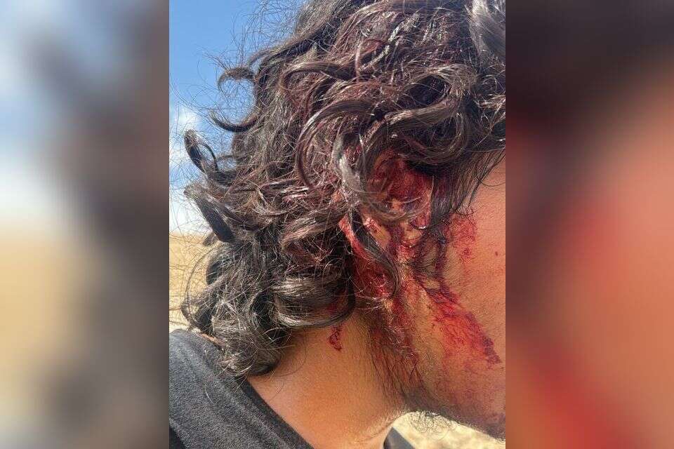 רועה הצאן שהותקף ליד מבוא יריחו , ללא