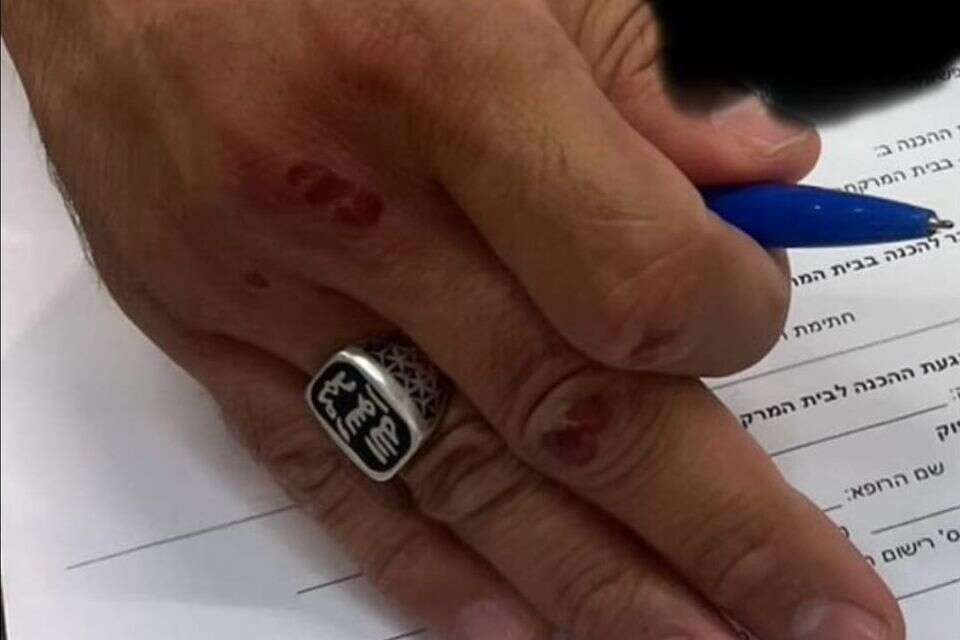 טבעת של דאעש שנענדה על ידי רוקח בפתח תקווה  , ללא קרדיט 