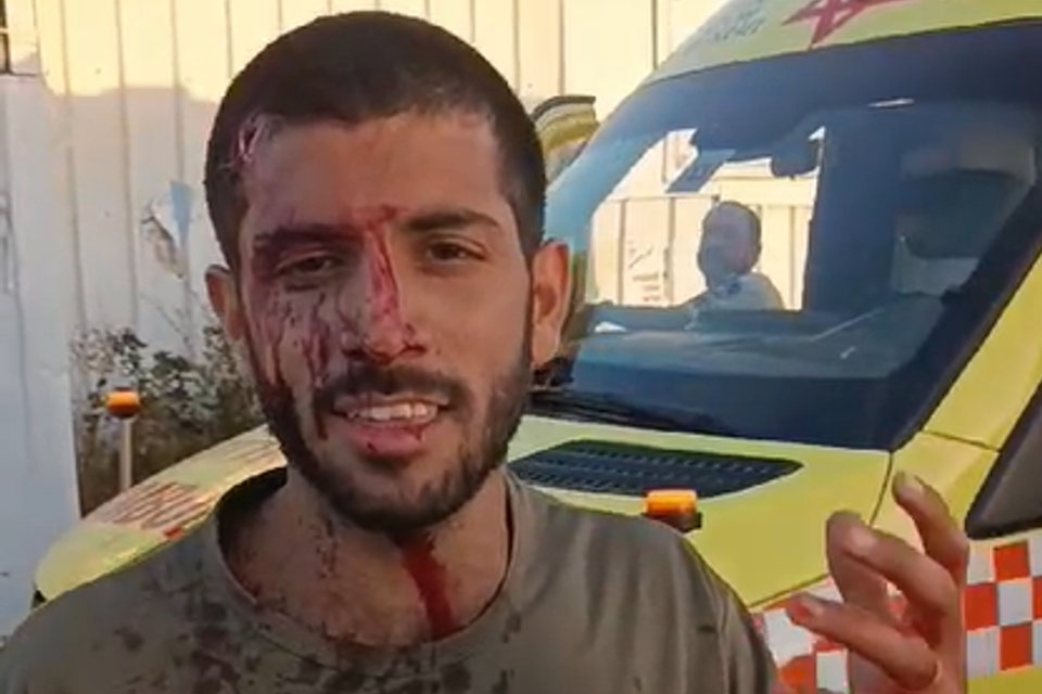 לינץ' ערבי על רועי הצאן בחוות העיטם שעות אחרי שנשקו של בעל החווה הוחרם , ללא