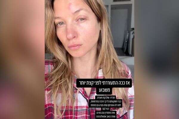 עדי הימלבלוי , צילום מסך מהאנסטגרם