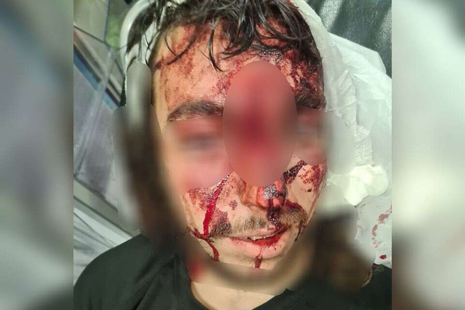 פיגוע בבנימין: רועה צאן נדקר בשטחי המרעה ופונה לבית החולים , ללא