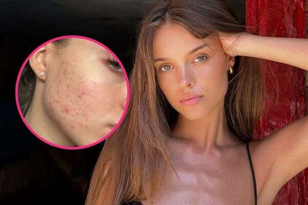 אנה זק , מתוך אינסטגרם