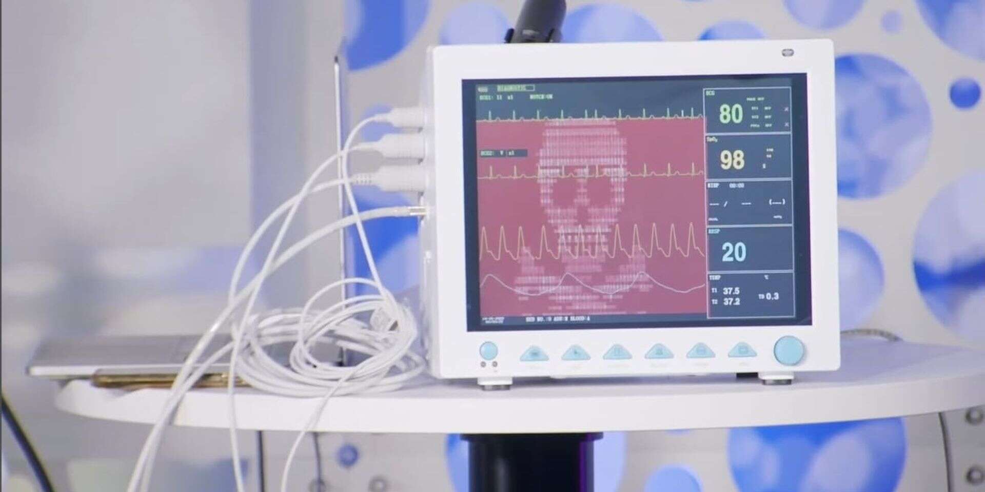 המשחה של מערכת קלארוטי , קלארוטי