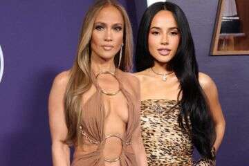 עור חשוף ומנומר: הלוקים מטקס ה-AMA