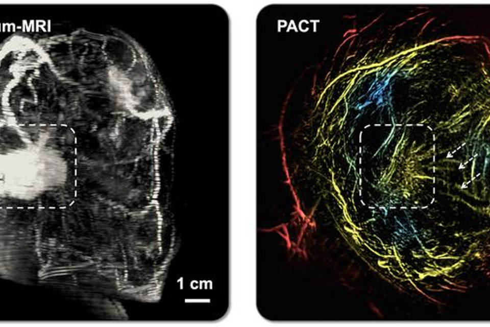 MRI משמאל, PACT מימין , Xin Tong/Caltech Optical Imaging Laboratory