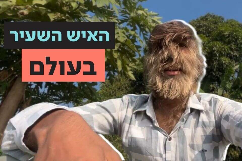 לליט פאטידאר- האדם השעיר בעולם , ללא קרדיט