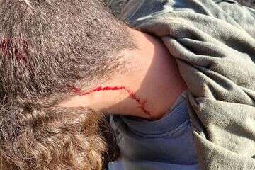 רועה צאן נפגע מירי בשילה , אביתר קארו/TPS