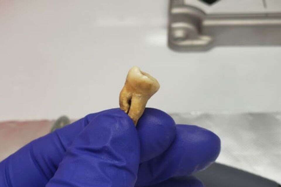 בעזרת השן: מחקר חדש חושף את סוד המגפה הכי קטלנית בהיסטוריה