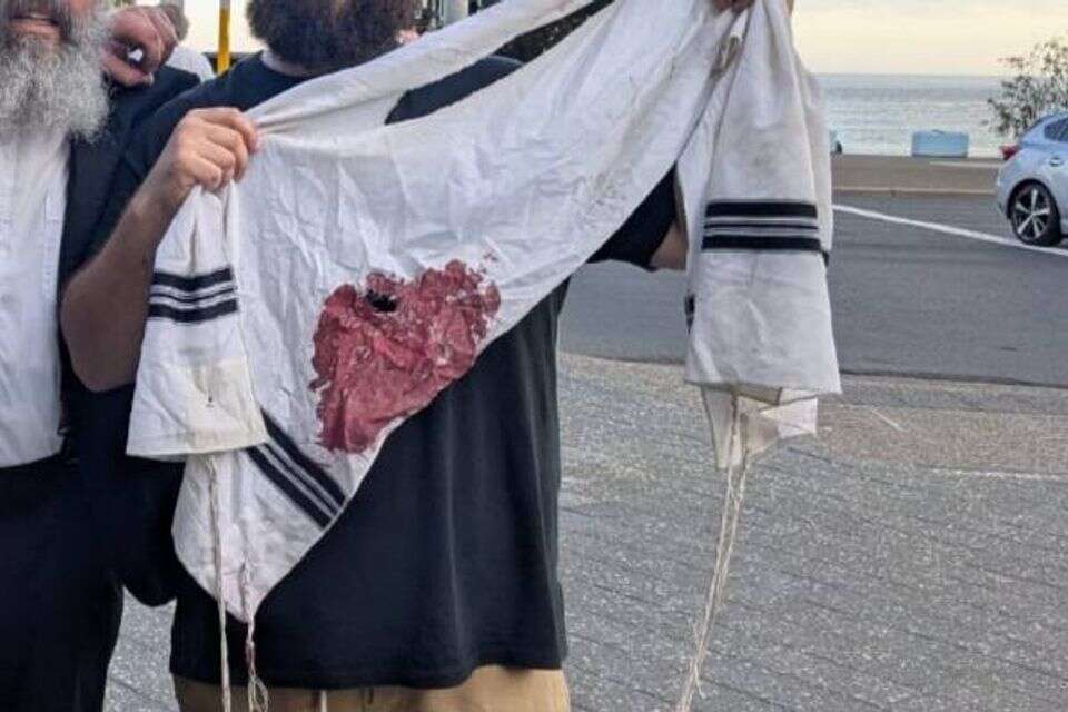 טלית אחד הנוכחים מגואלת בדם , השימוש לפי סעיף 27א' לחוק זכויות היוצרים