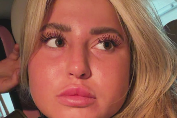 שלקה , אינסטגרם