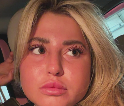 שלקה , אינסטגרם