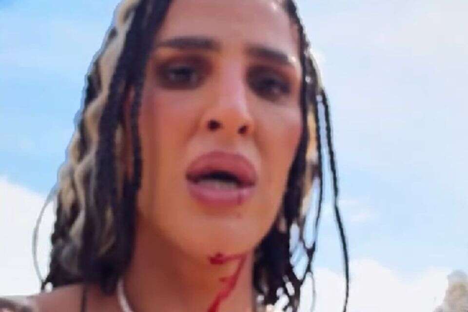 The vacation that went wrong: Einav Bobalil had an ATV accident in Thailand