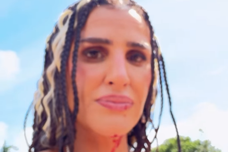 Einav Bobalil had an accident with her daughter in Thailand: "My head opened"