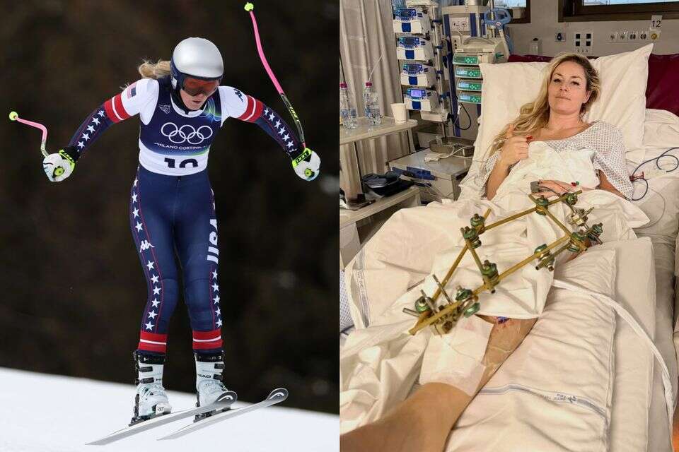 "Could end in amputation": Lindsey Vonn in the fight for the leg