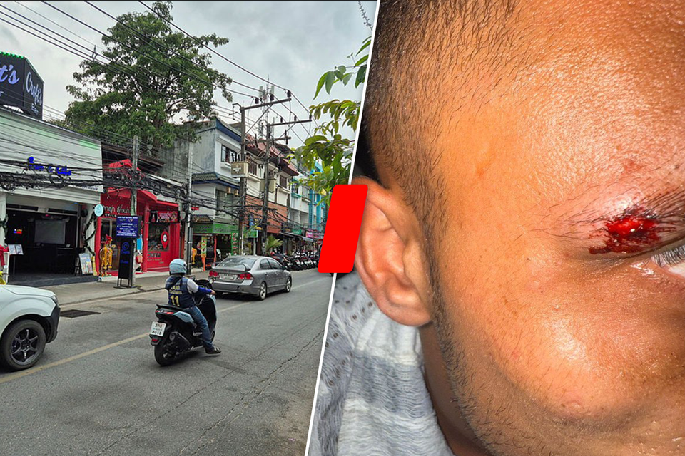 Three Israelis were attacked in Kosmoy: "French-Arabs beat them"