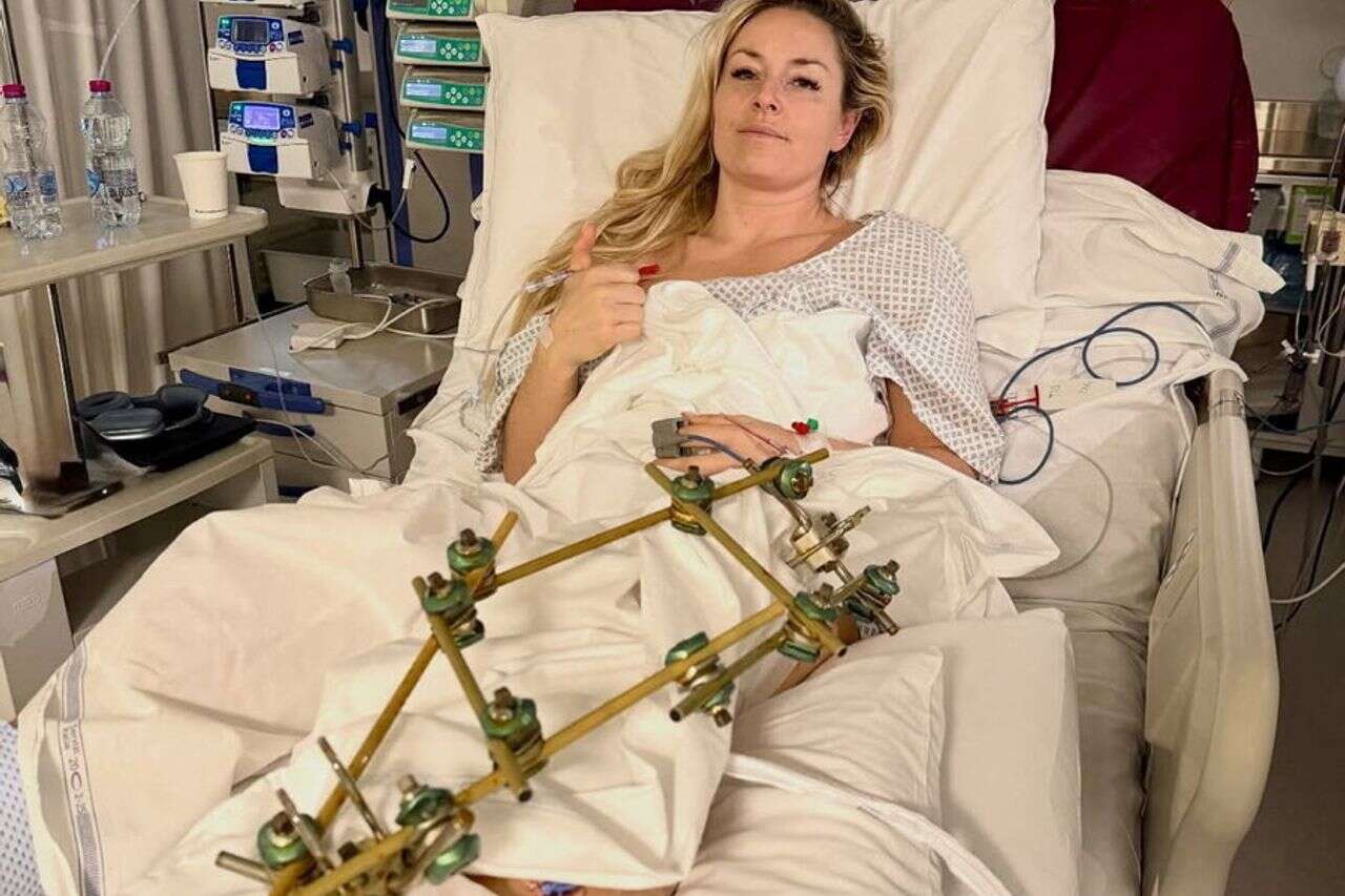 After 85 days: The comeback of Lindsey Vonn