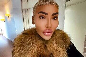 תאונה קוסמטית? "מלך השפתיים" מת בגיל 34