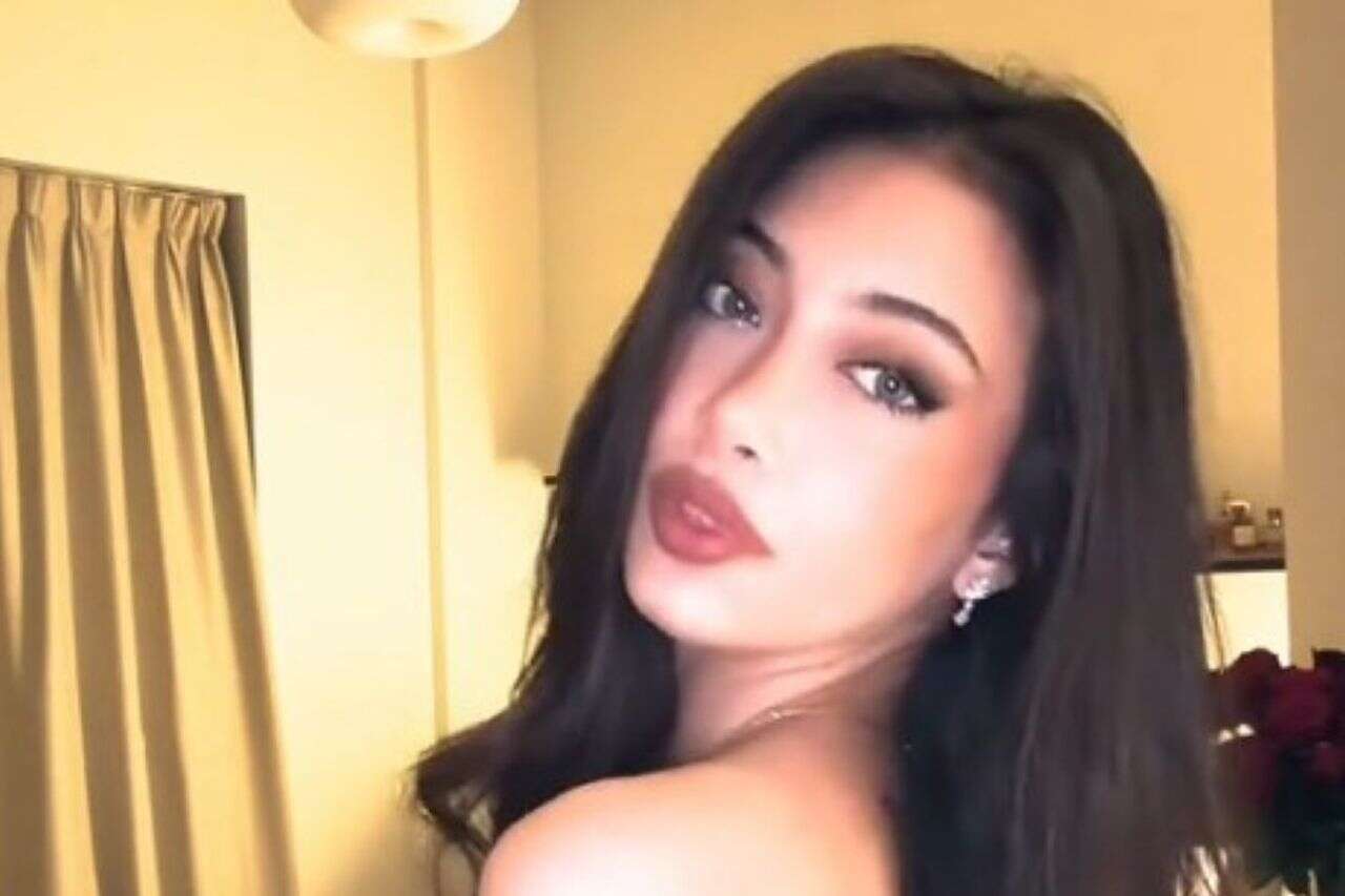 Problematic timing: an influencer flew to Iran for a nose job - and got stuck in the war