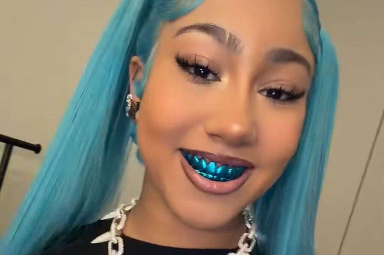 14 carat teeth cover: the North West accessory