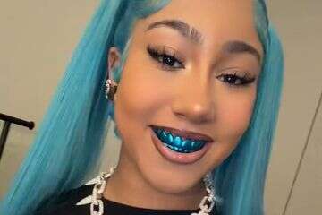 כיסוי לשיניים 14 קראט: האקססורי של נורת' ווסט