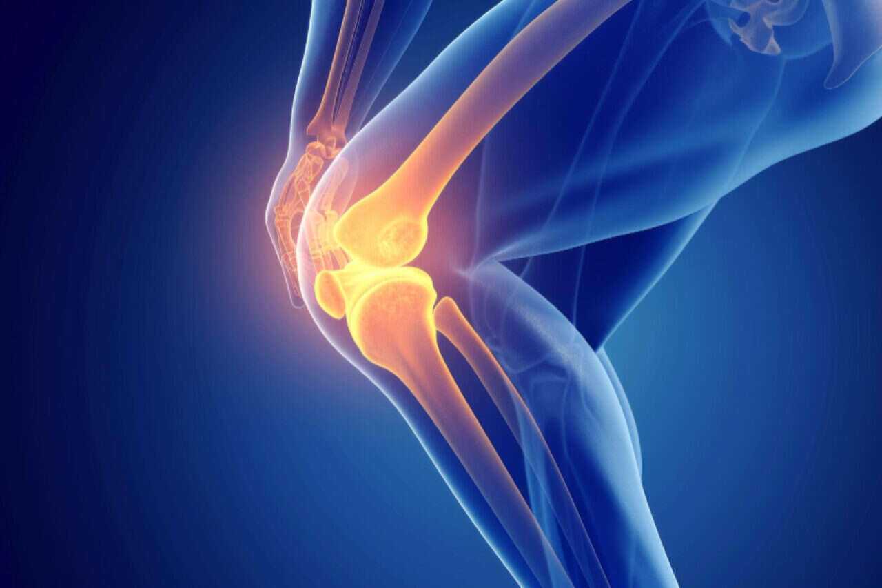 Did you receive "news" about a meniscus tear? Before you run to surgery - the guide that everyone must read