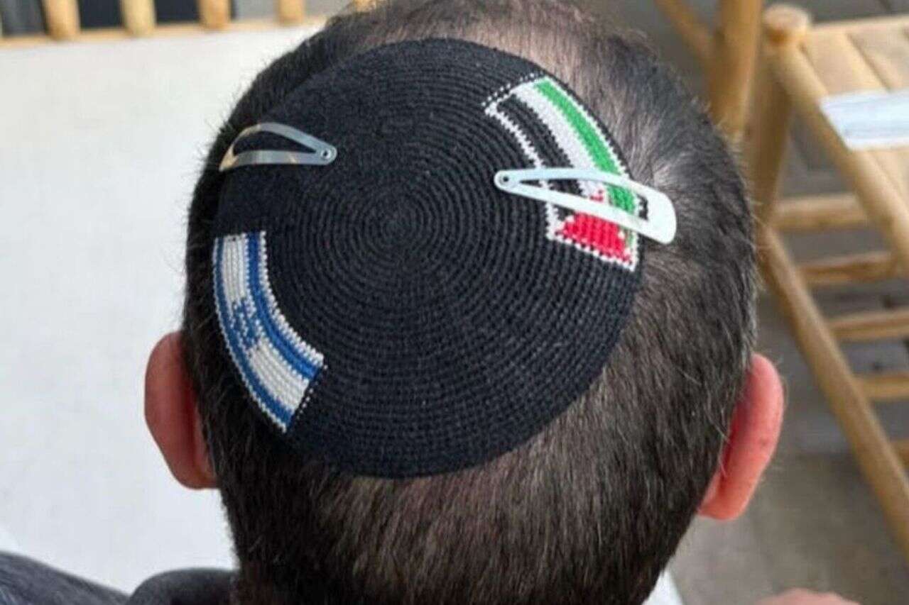 On the eve of Memorial Day: police vandalized a kippa with Israeli and Palestinian flags