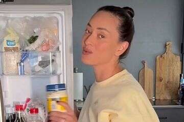 אחרי שנים: אנה ארונוב עוברת טיפול לשינוי המראה