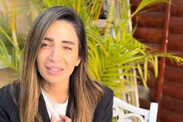 חיה בוקובזה עברה ניתוח ששינה את פניה: "לא פשוט"