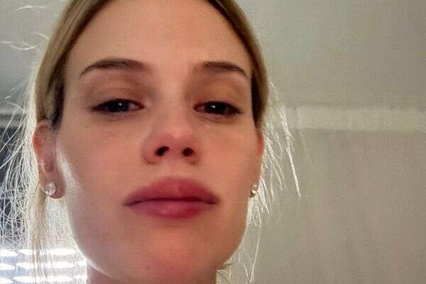 חלתה חודשים ספורים אחרי הלידה. בר זומר , אינסטגרם