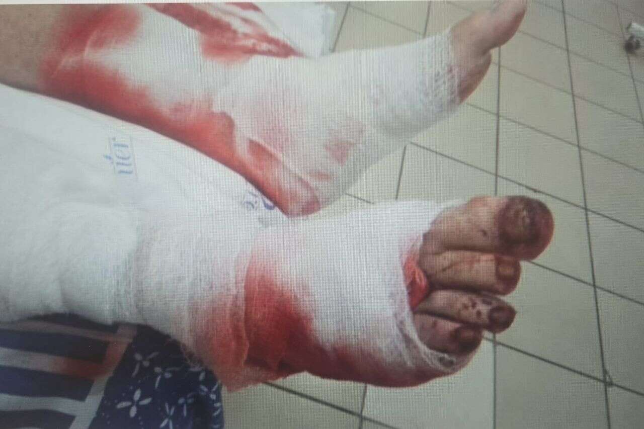 He was robbed, a dog was set on him and stones were thrown at him: a 72-year-old man was brutally attacked in Ashdod